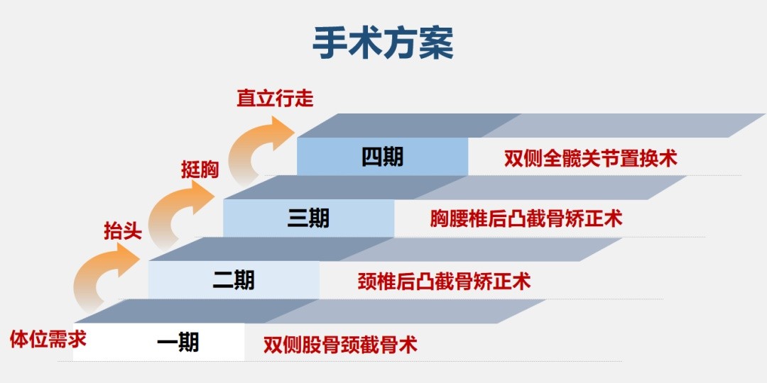 “折叠人”李华：骨头被敲断4次，植入22颗钢钉，如今重获新生