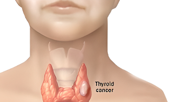 穿越火线里最好的枪_穿越火线贝雷塔_穿越火线M37霰弹枪